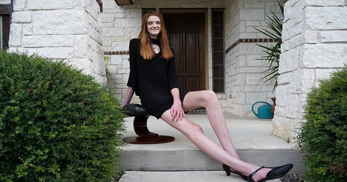 e18486e185aee1848ce185a6 2020 10 12t014244 965.jpg?resize=412,232 - Meet The 17-Year-Old Woman Who Has The Longest Legs In The World