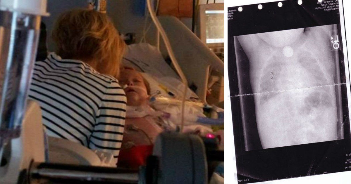 e18486e185aee1848ce185a6 2020 10 16t014630 214.jpg?resize=412,275 - Parents Warn Others After Their Little Boy Swallowed A Small Lithium Button Battery