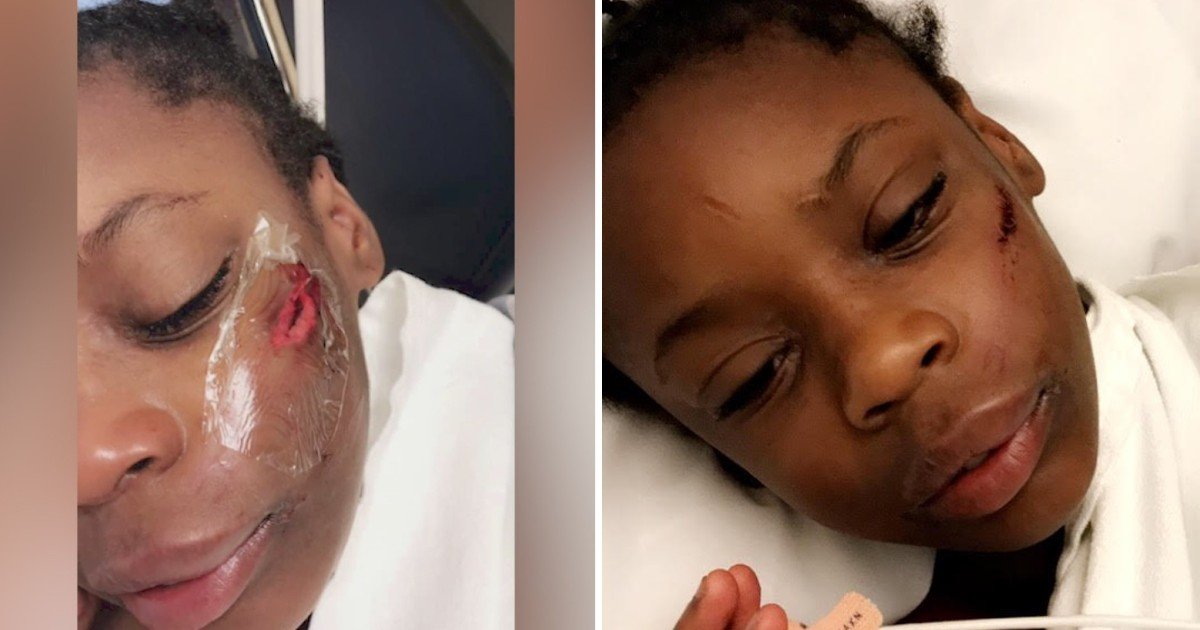 e18486e185aee1848ce185a6 28.jpg?resize=1200,630 - Racist Attack Leaves Young Black Girl Hospitalized After Being Slammed With Metal Pole