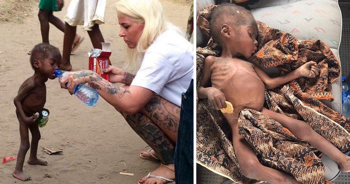 e18486e185aee1848ce185a6 3 1.jpg?resize=412,275 - A Starving Boy Was Left Alone By Family Because He Was Accused Of Witchcraft