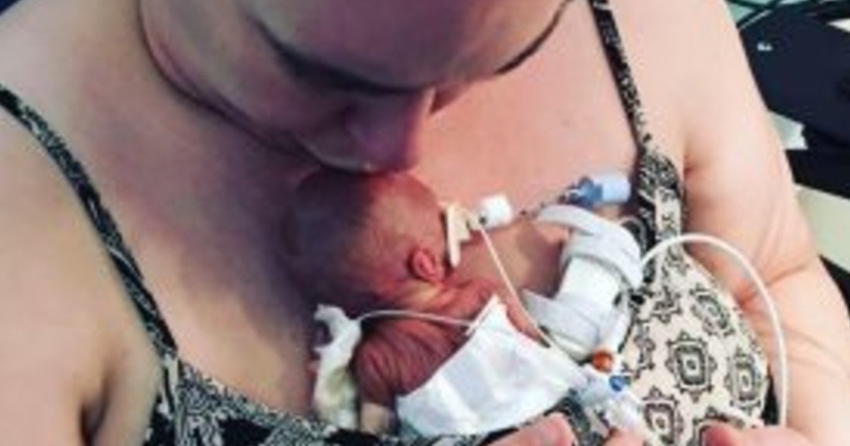 e18486e185aee1848ce185a6 40 3.jpg?resize=412,275 - Couple Was Blessed With Baby But Mom Was Told She Would Have To Give Birth At 22 Weeks