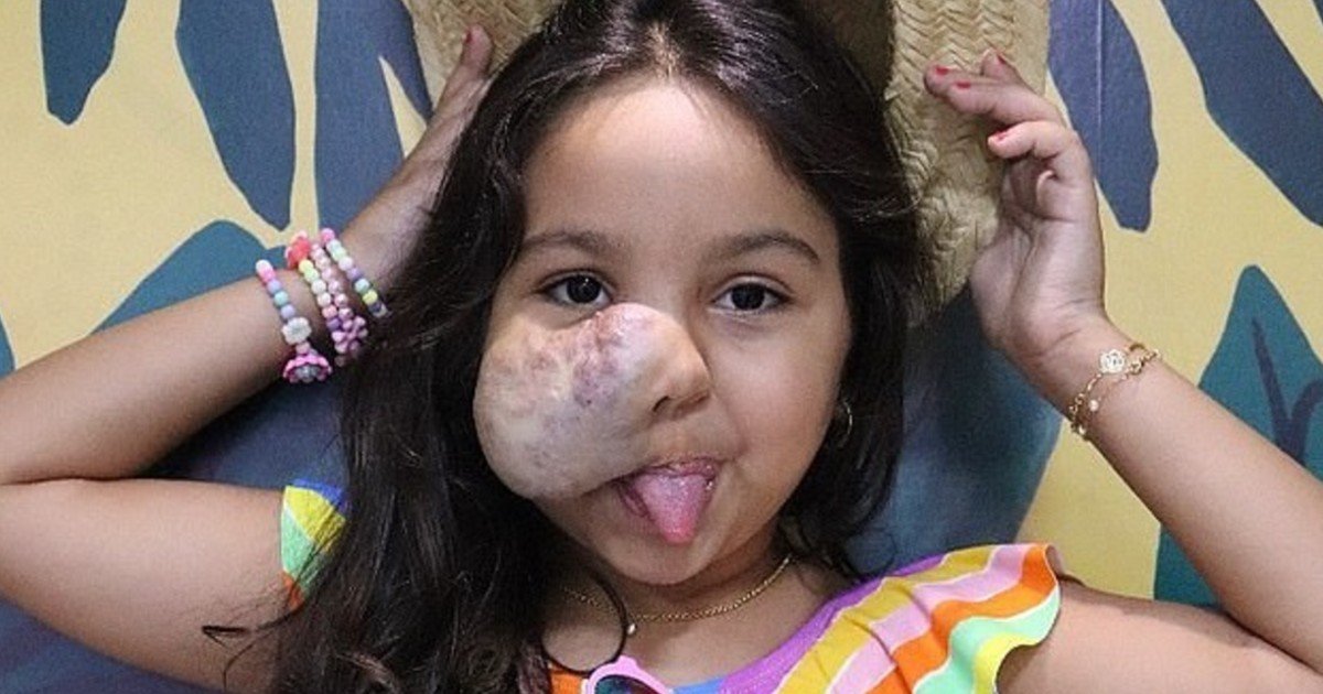 e18486e185aee1848ce185a6 63 1.jpg?resize=412,232 - 6-Year-Old Girl Born With A Large Facial Tumor Refuses To Look In A Mirror