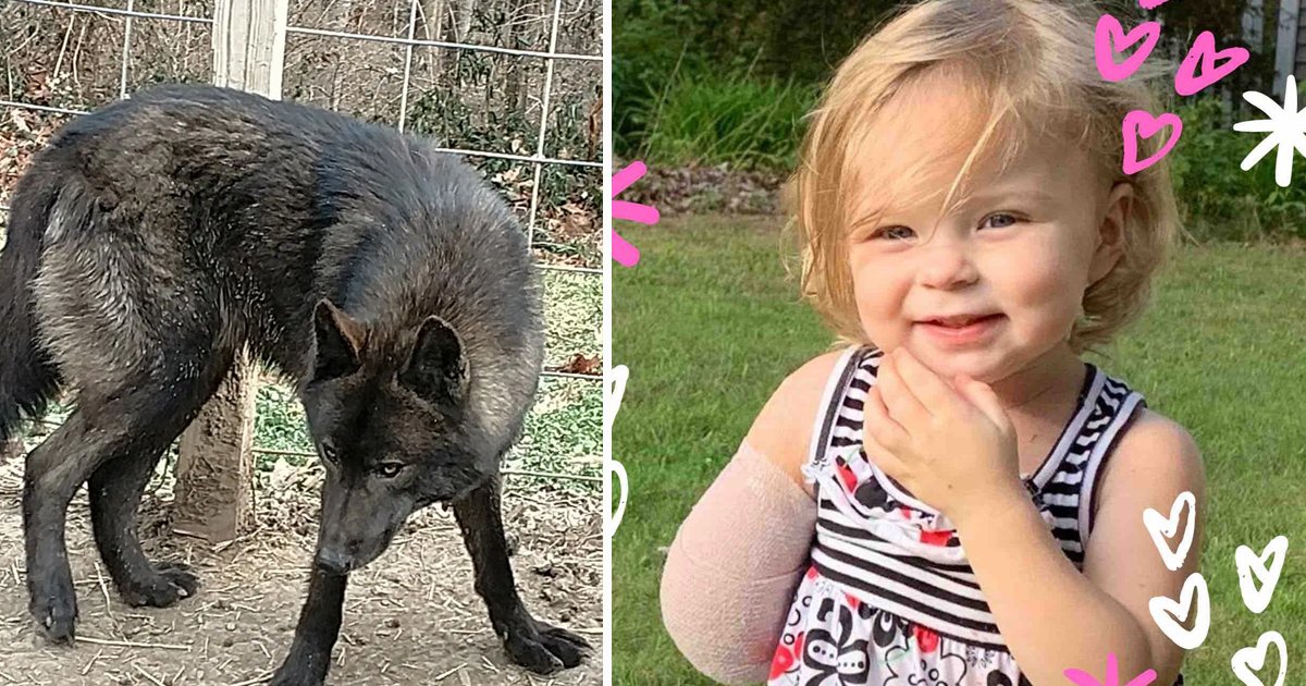 hssgs.jpg?resize=300,169 - Dog Violently Rips Off 2-Year-Old Girl's Arm After She Tried To Reach For Him In Michigan