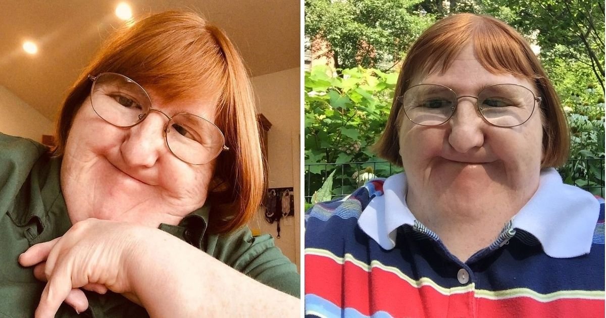 melissa6.jpg?resize=412,275 - Woman Who Was Told She Is 'Too Ugly' To Share Pictures Of Herself Responded By Posting A Selfie Every Day