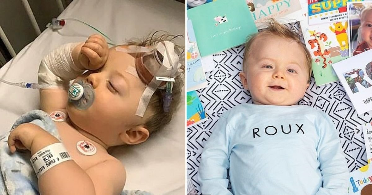 owen6.jpg?resize=412,275 - Baby Who Underwent 10 Operations And Survived A Giant Brain Tumor Celebrates His First Birthday