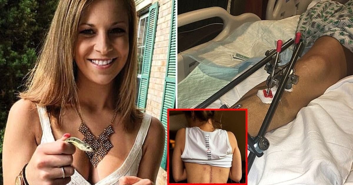 sarah8.jpg?resize=412,275 - Woman Who Was Left With Broken Back And Brain Injury After Failed Suicide Attempt Shares Her Heartbreaking Story