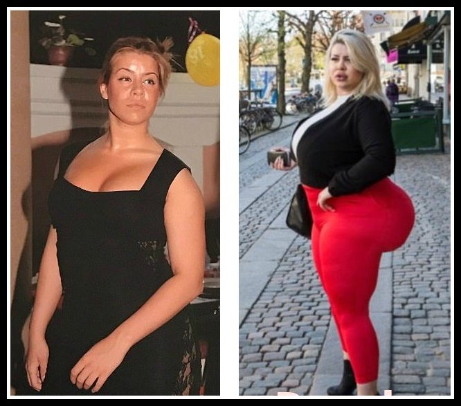 Natasha Crown Before Surgery A Woman Aspiring To Get The ‘Biggest Bum