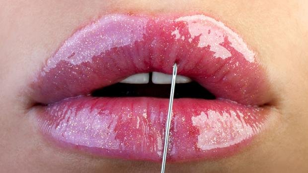 Una joven se opera los labios y casi se queda ciega a causa de una infección tras la intervención