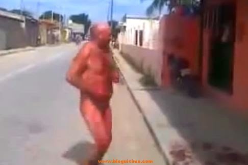 Hombre borracho se corta los genitales en plena calle | BLOGUISIMO