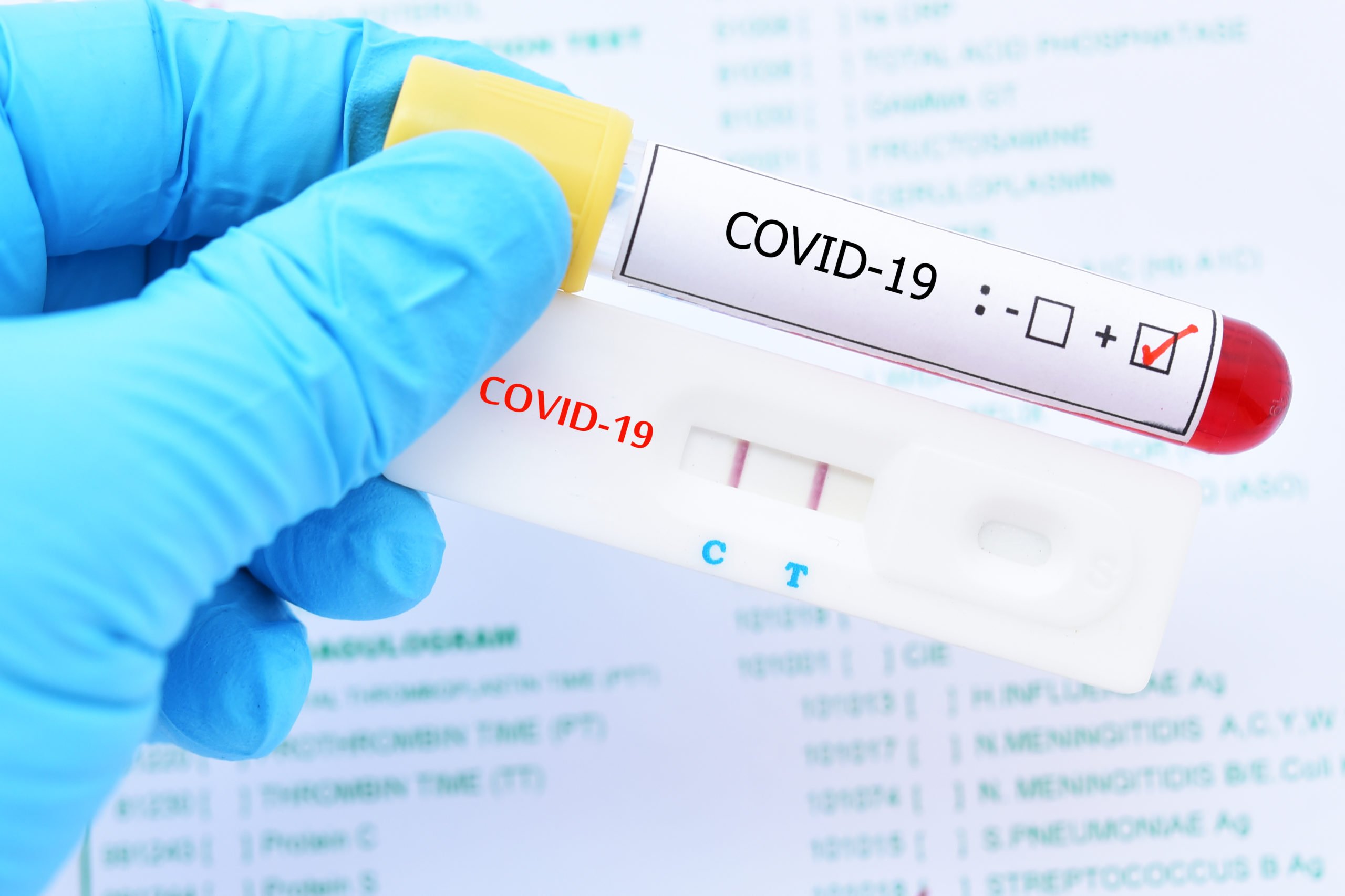 Qué diferencia hay entre las PCR y los test rápidos para el diagnóstico del Covid-19? - El Global