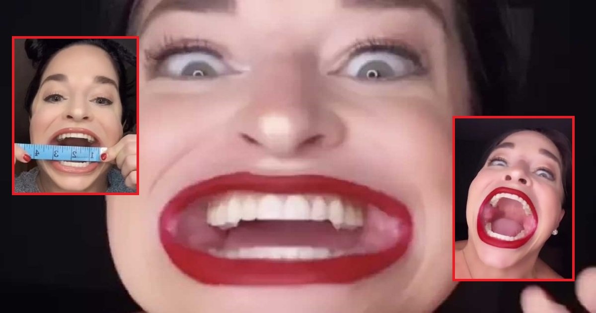 9 bouche.jpg?resize=412,275 - La chanteuse de TikTok Samantha Ramsdell, possède "la plus grande bouche du monde"