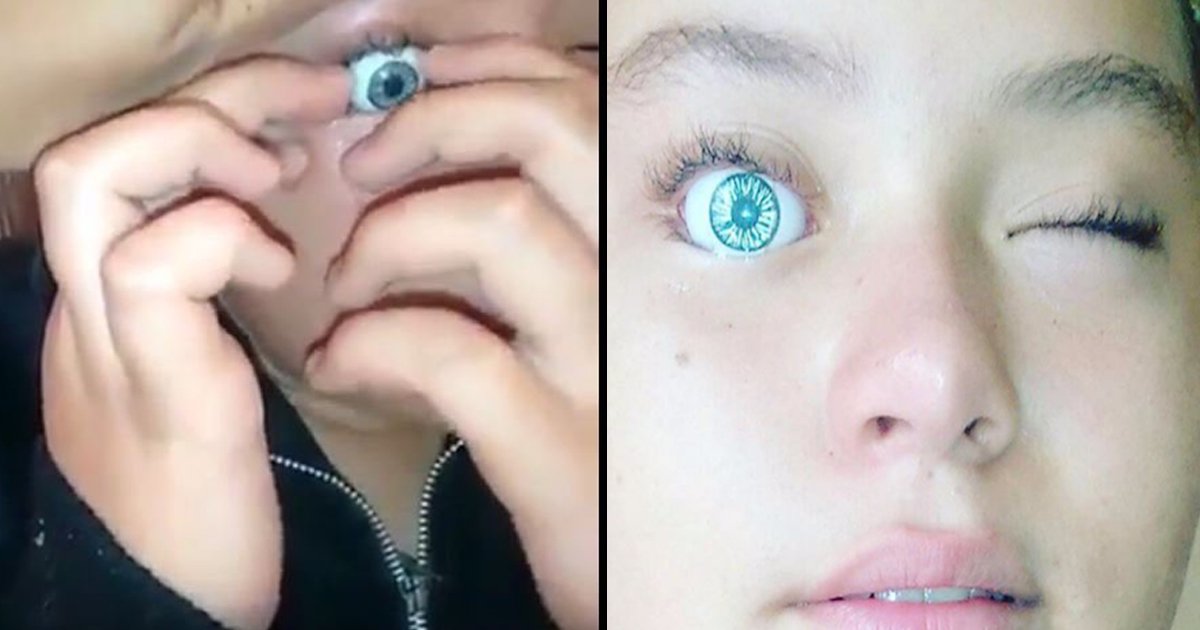 barbie eye stuck in eye