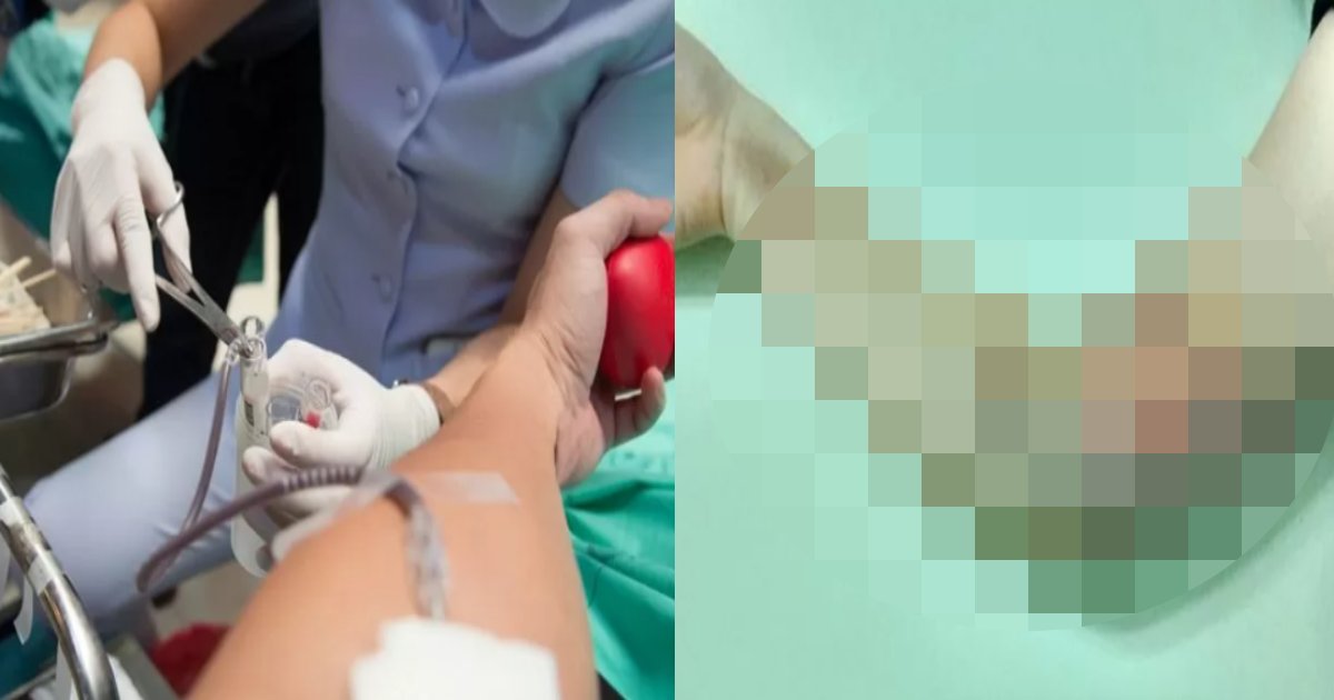 kenktu itai.png?resize=412,275 - 「献血しに行ったら、動脈から血を抜いた初心者看護師のせいで難病にかかりました」