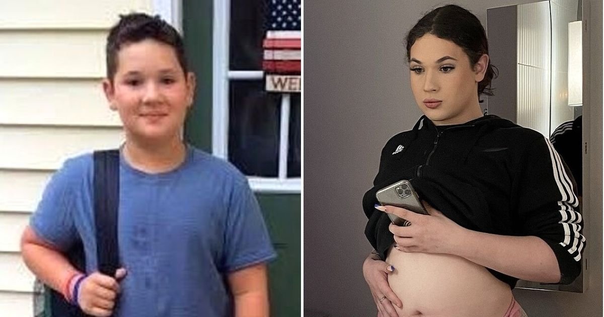 mikey7.jpg?resize=412,275 - Teen Who Was Born With Male Privates Is Now Four Months Pregnant