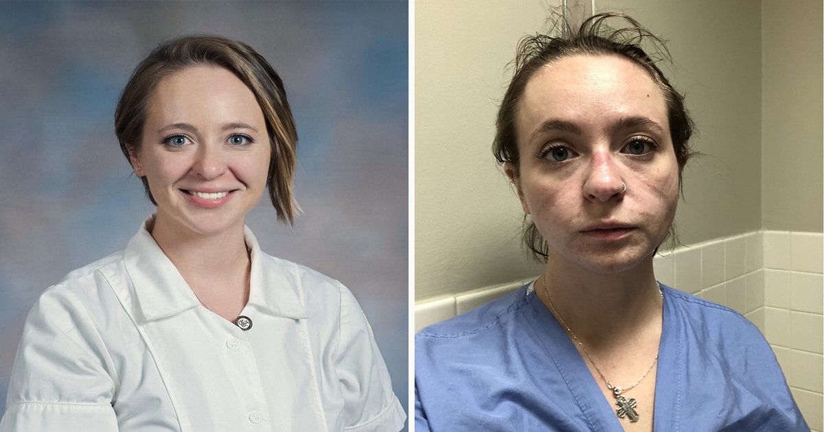 webp net resizeimage.jpg?resize=1200,630 - Une infirmière en service Covid-19 partage des photos de son "avant et après"