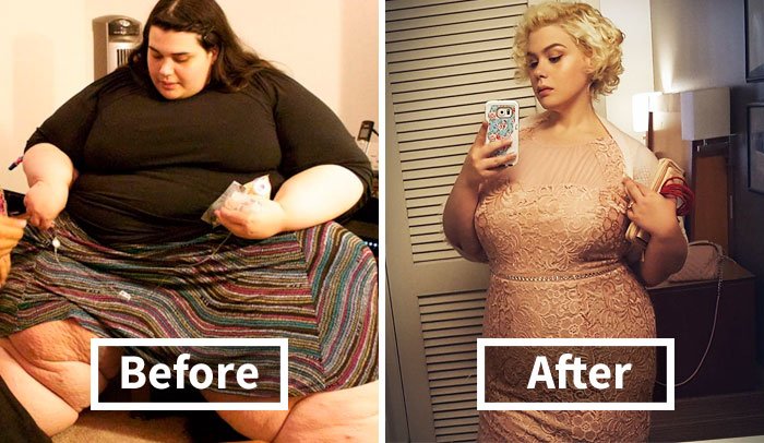 before and after weight loss 