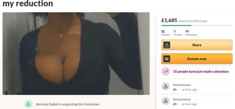 Student with 32HH boobs crowdfunds to raise money for breast reduction | Metro News