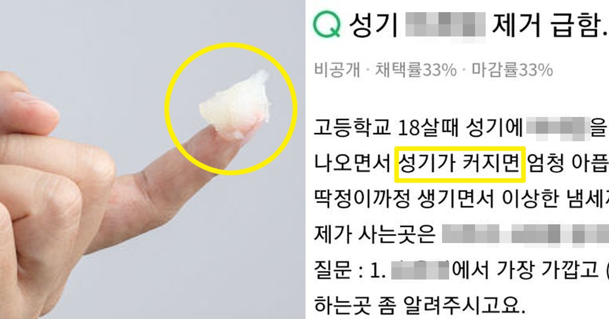 7.jpg?resize=1200,630 - "성.기 확대하고 싶어서 OOO 주입했다가 망했어요"