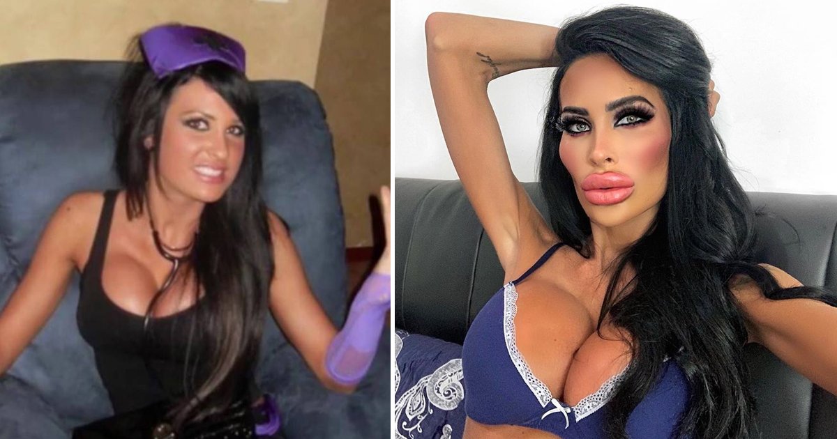 dsfgsgsg.jpg?resize=412,232 - ‘Plastic Barbie’ Junkie Spends £55,000 On Surgery Admits She’s ‘Addicted’