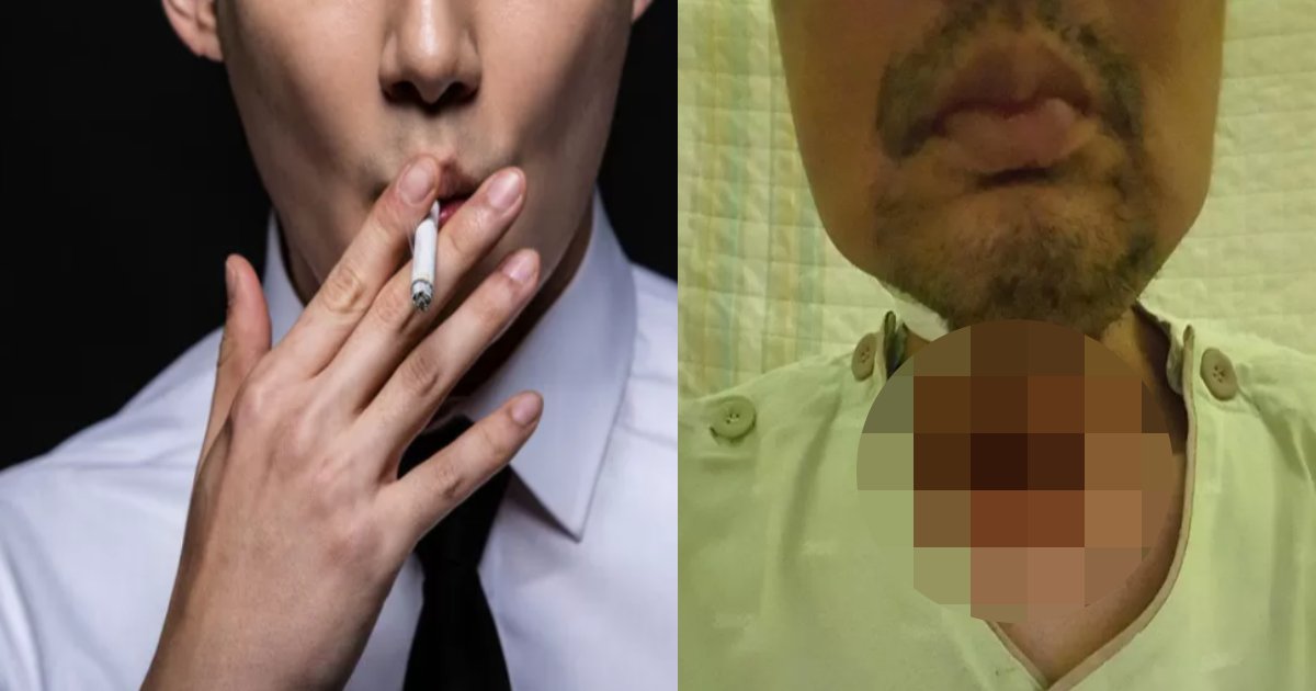 kinen tabako.png?resize=412,275 - 35年間タバコを吸ってきた男性が本気で「禁煙しなさい」と公開した写真