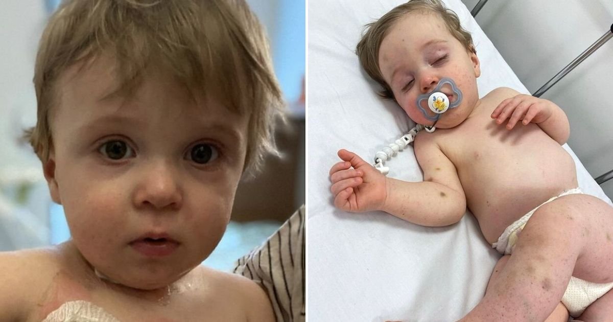 max5.jpg?resize=1200,630 - Baby Boy With 'One In A Million' Condition Is Set To Undergo A Life-Saving Transplant