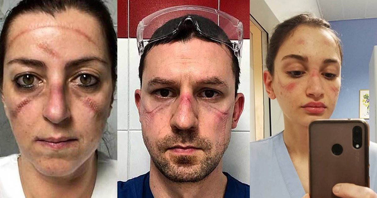 rrewrwer.jpg?fit=1024%2C538&ssl=1&strip=all - Global Frontline Healthcare Workers Fighting COVID-19 Share Grueling Experiences