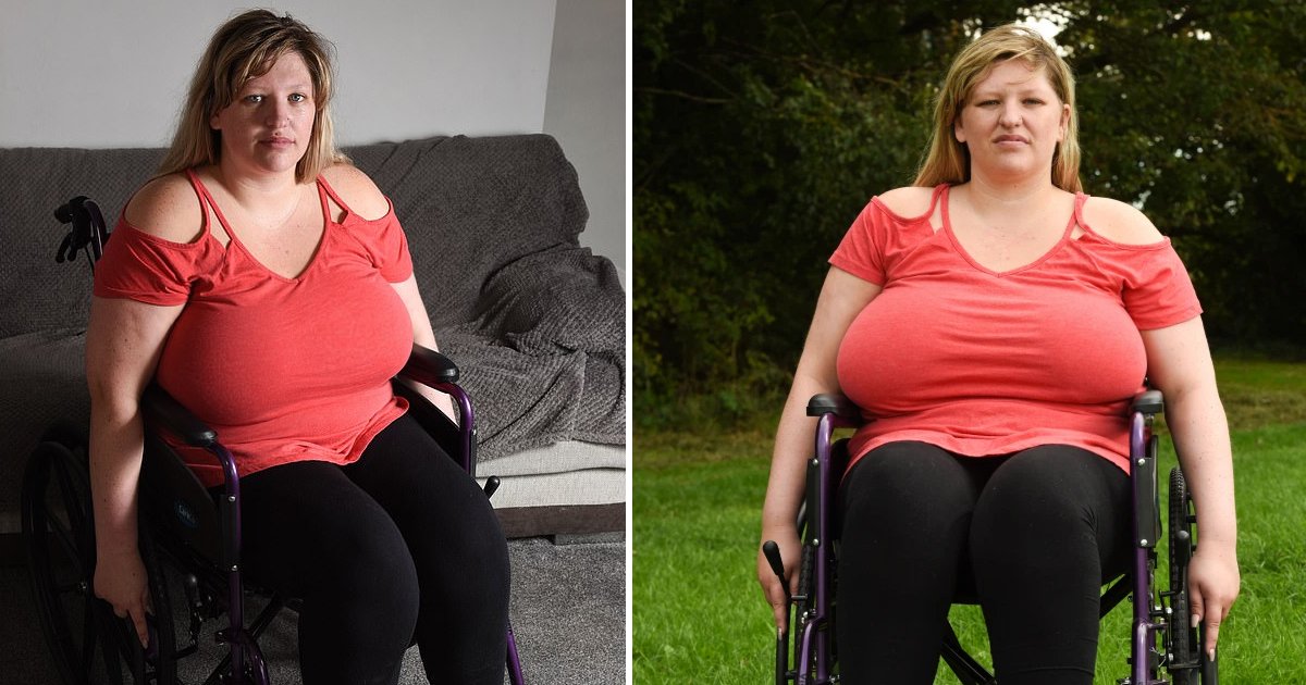 Womans Massive 42i Breasts Left Her Wheelchair Bound Small Joys 