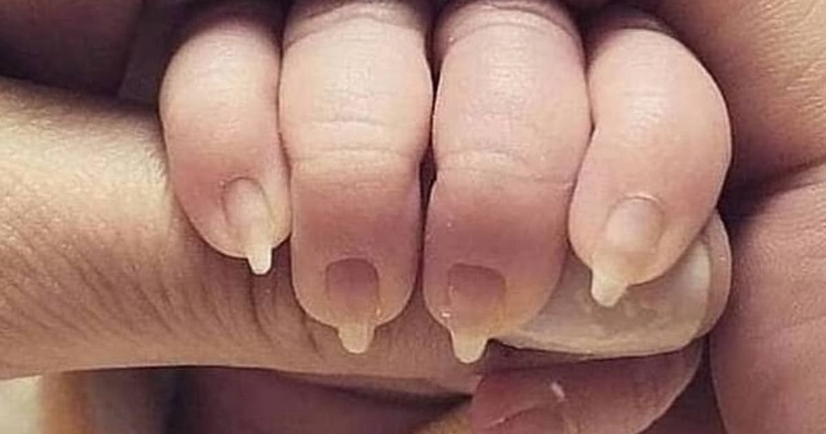 untitled design 2 9.jpg?resize=1200,630 - Mother Slammed After Sharing Photos Of Her Baby’s Sharp Nails