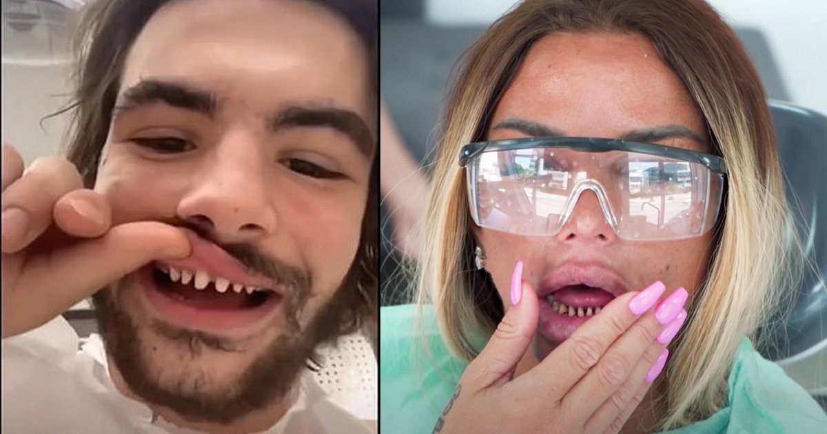 yyryry.jpg?resize=412,275 - Dentists Are Slamming TikTok Stars For Shaving Down Their Teeth