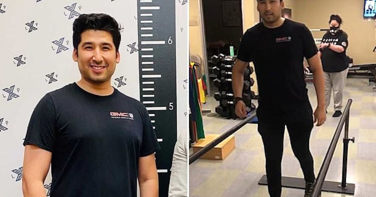 alfonso5.jpg?resize=412,232 - Man Undergoes Surgery To Increase His Height Because He's Always Dreamed Of Being Tall