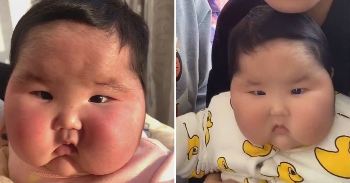 baby5 2.jpg?resize=412,275 - Mother Left Horrified After Baby's Face Ballooned And Started Growing Hair