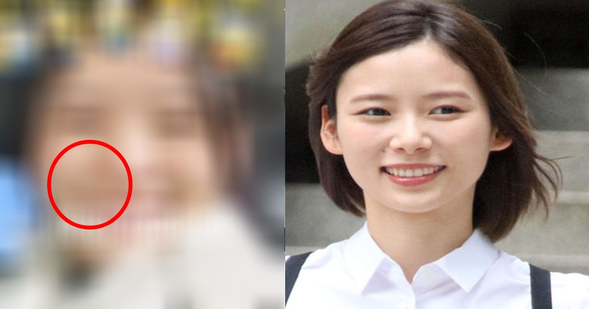 朝日奈央 コンプレックスのホクロ除去告白で現在の顔公開 ハッピーな気持ち Hachibachi 朝日奈央 コンプレックスのホクロ除去告白で現在の顔公開 ハッピーな気持ち Hachibachi