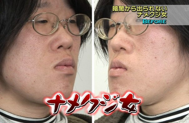 整形美容 ナメクジ女と言われた女性が整形したら スタジオが騒然 Hachibachi 整形美容 ナメクジ女と言われた女性が整形したら スタジオが騒然 Hachibachi