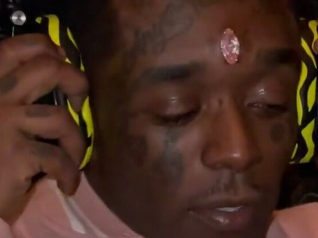 Resultado de imagen de rapero Lil Uzi Vert se injerta en la frente un diamante