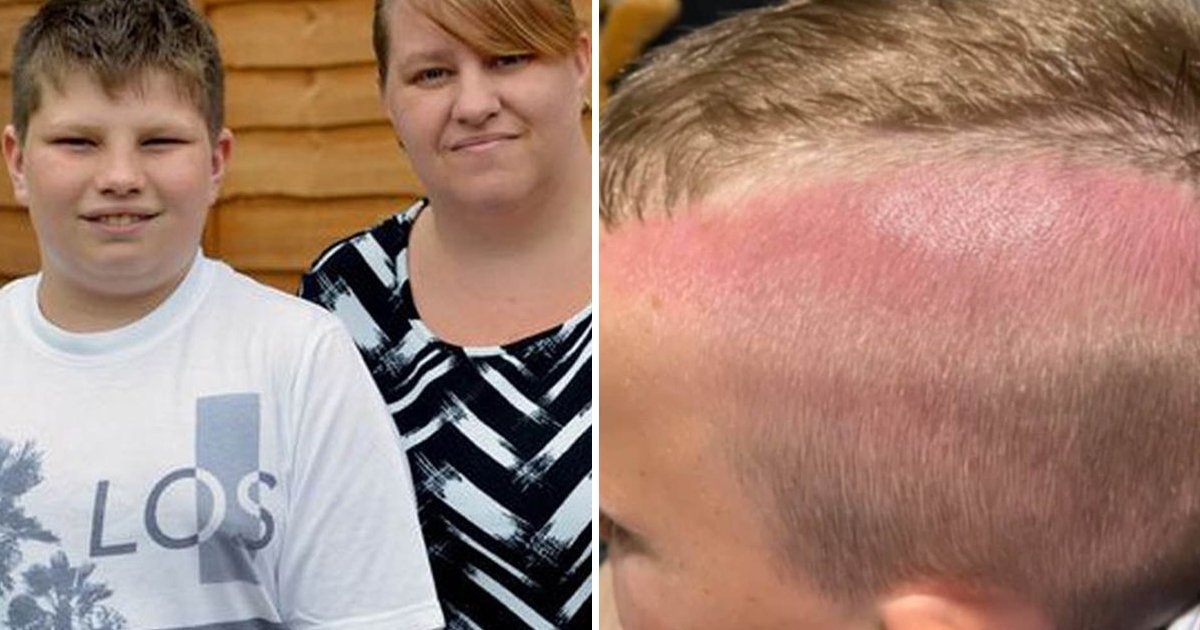 ddddd.jpg?resize=412,275 - Mum Slams School After Son Returns Home With 'Serious Sunburn'