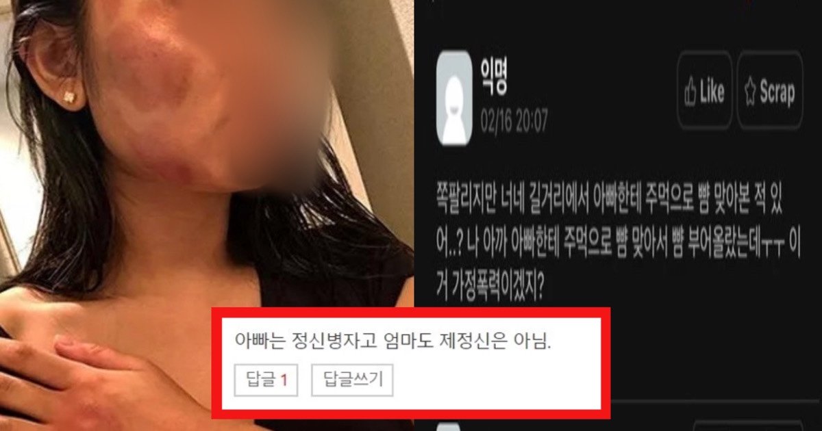 ed8fadeba0a5.jpg?resize=412,232 - "아빠 마스크 쓰세요..."  길에서 xx년 소리 들으며 주먹으로 맞은 딸의 한마디 (+전문)