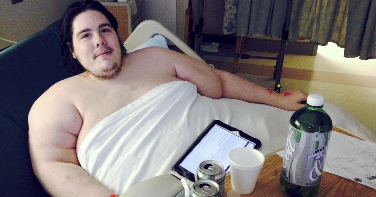 This 800 Pound Man Looks Like A Completely Different Person After Shedding Half His Body Weight