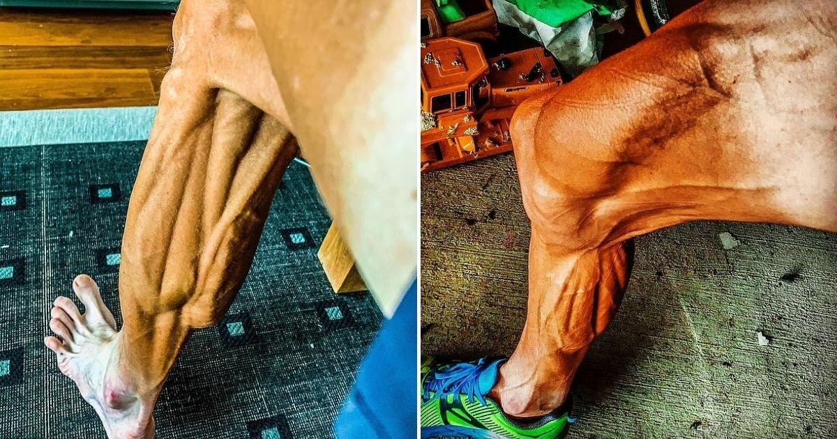 smalljoys 5.jpg?resize=412,232 - Former World-Champ Cyclist  Revealed Shocking Pictures Of His Legs After His Comeback Race