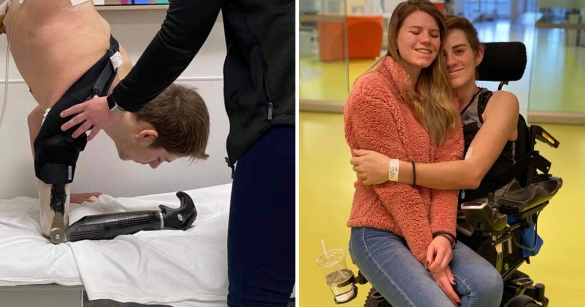 trtrttt.jpg?fit=1024%2C538&ssl=1&strip=all - "Love Overcomes All"... Boy Survives Losing His Lower Body, Thanks To Girlfriend's Love