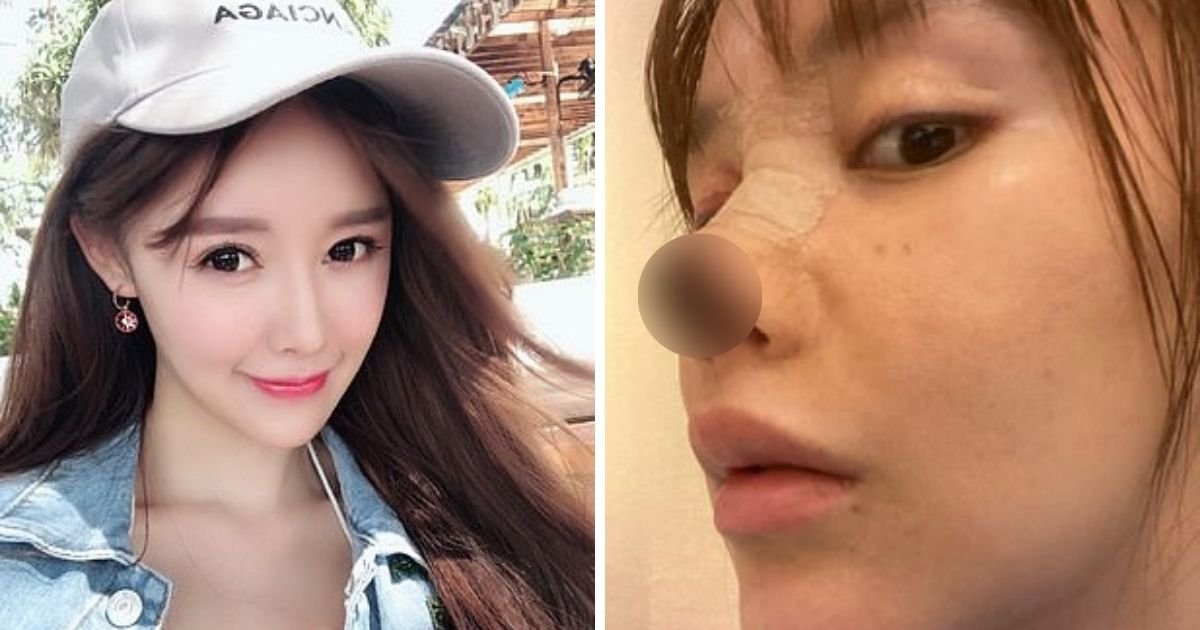 untitled design 2 3.jpg?resize=1200,630 - Actress Reveals How She Lost The Tip Of Her Nose After It Fell Off Following An Infection Caused By Botched Cosmetic Surgery