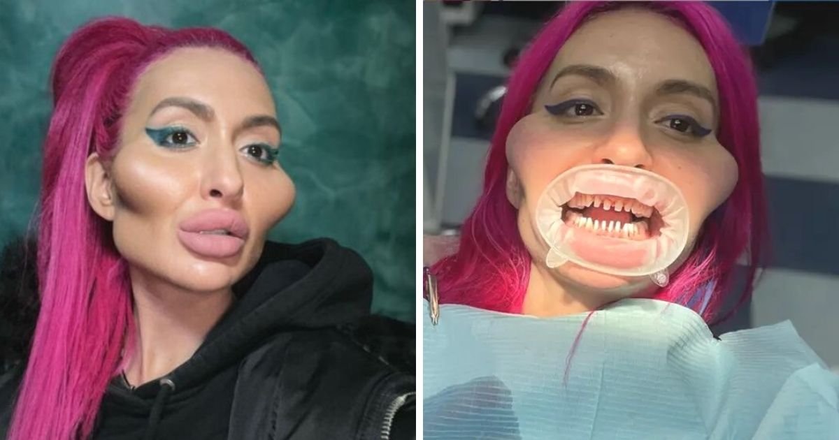 untitled design 6 8.jpg?resize=412,232 - Woman With World's Biggest Cheeks Stuns Fans As She Shows Off Her Real Teeth