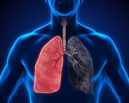 무시하면 안 되는 폐렴 증상 8가지 — 건강을 위한 발걸음