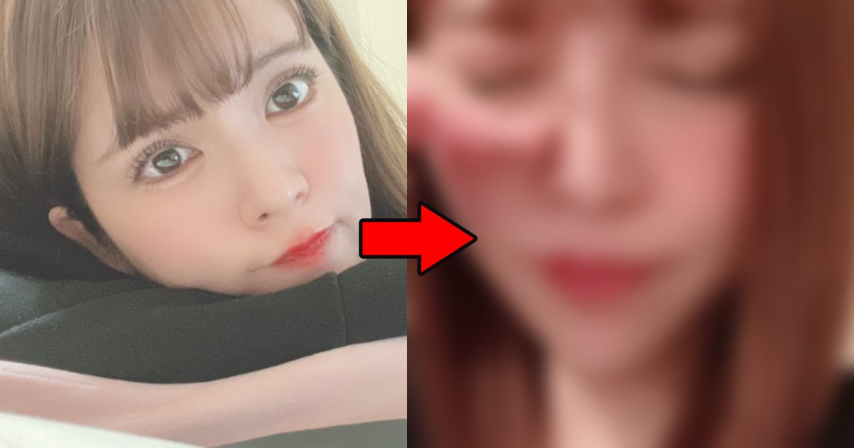 anrisejyutu.png?resize=1200,630 - 坂口杏里が二重埋没の手術を行ったことを告白も皮肉の声多数「そのお金は一体どこから…」