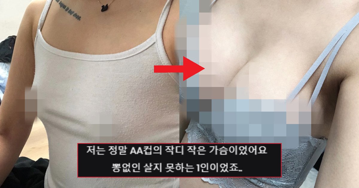 d853299d d339 48dc b121 26427658d361.jpeg?resize=412,275 - “AA에서 D컵 된 ‘찐’ 후기 들려준다”…너무 신기한 요즘 ㄱr슴수술 후기.jpg