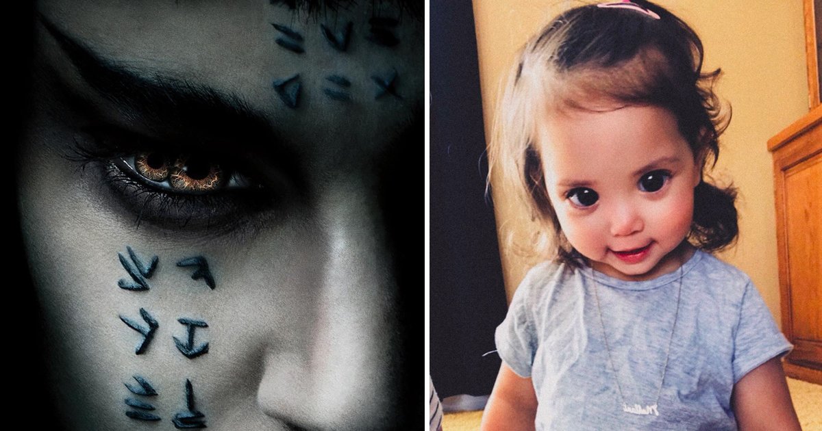 eertttt.jpg?fit=1024%2C538&ssl=1&strip=all - Pupula Duplex | Everything You Need To Know About The Rare Double Pupil Condition