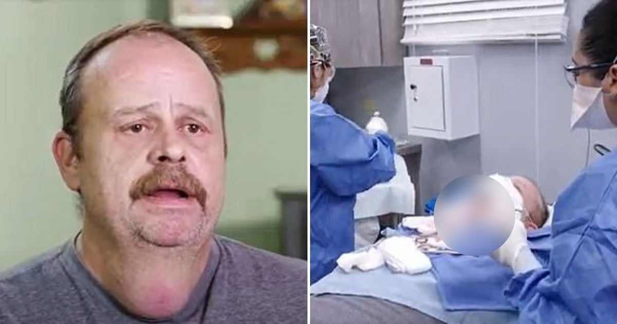 lump6.jpg?resize=1200,630 - Man With Huge 20-Year-Old 'Neck Testicle' Finally Has It Removed From His Throat