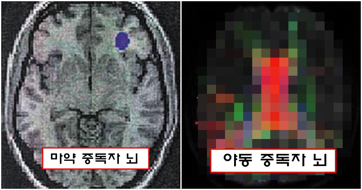 page 315.jpg?resize=412,275 - oㅑ동을 과하게 많이 본 사람에게 생겨버린 뇌 모양 변화