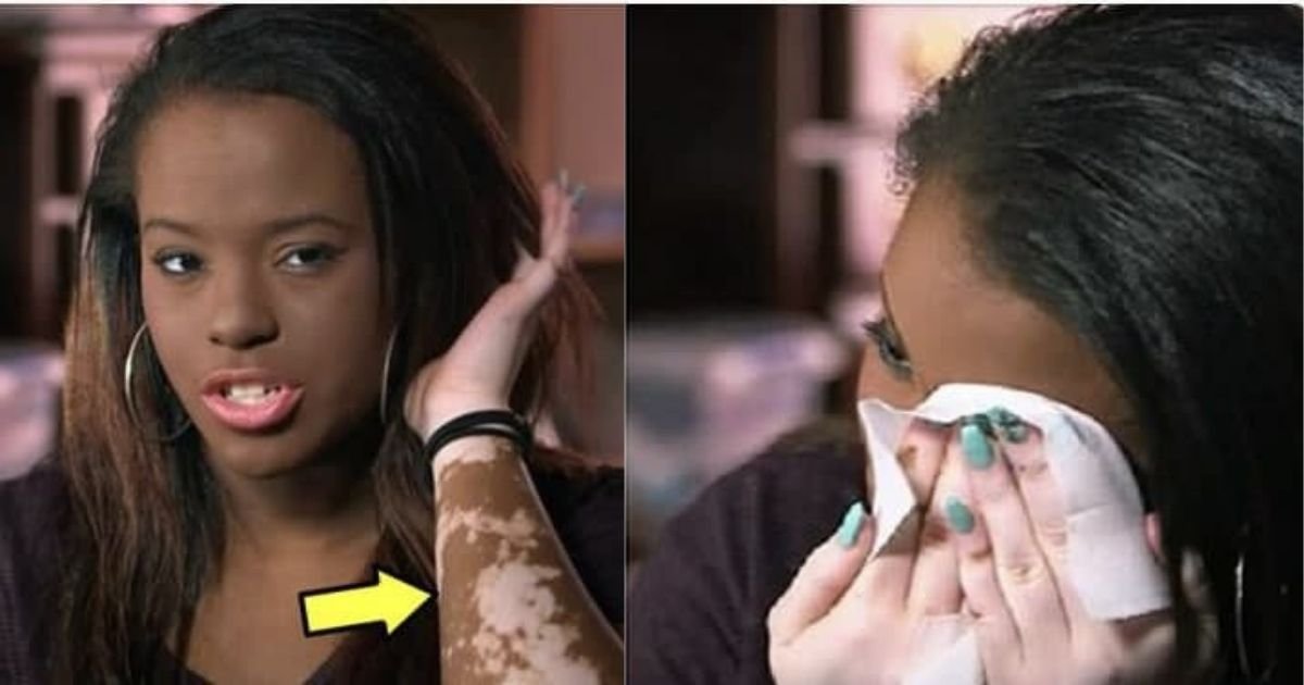 smalljoys 1.jpg?resize=1200,630 - Woman Finally Accepted Vitiligo After Years Of Sleeping With Foundation On 