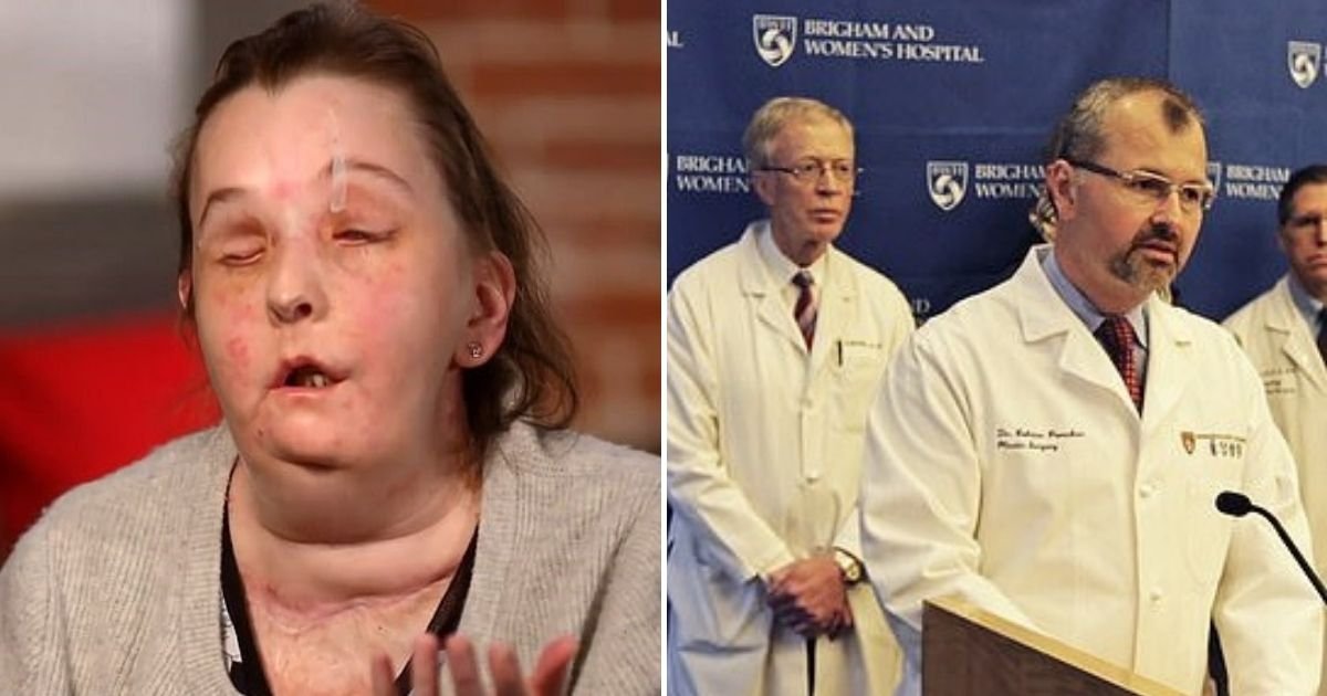 transplant8.jpg?resize=1200,630 - Woman Becomes First American To Successfully Undergo A Second Face Transplant