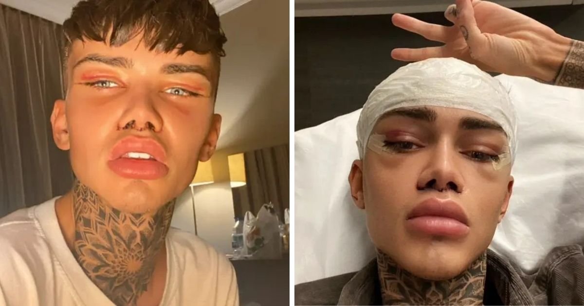 untitled design 5 3.jpg?resize=412,232 - Man Spends A Fortune On Surgeries To Look Like An Instagram Filter